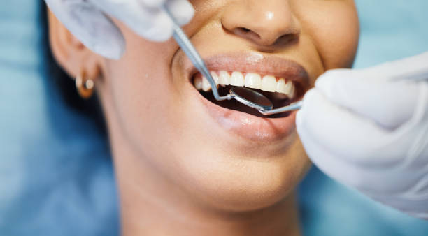 Best Broken or Cracked Tooth Emergency Dentist in Port Arthur, TX
